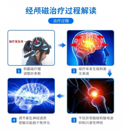 优瑞德九个头经颅磁刺激仪|哪些食物可以缓解儿童多动症